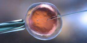 Все, что нужно знать об ЭКО по ОМС