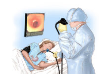 Гастроскопия: раскрытие внутреннего устройства пищеварительной системы