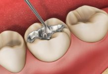 Изучение основных особенностей стоматологических услуг