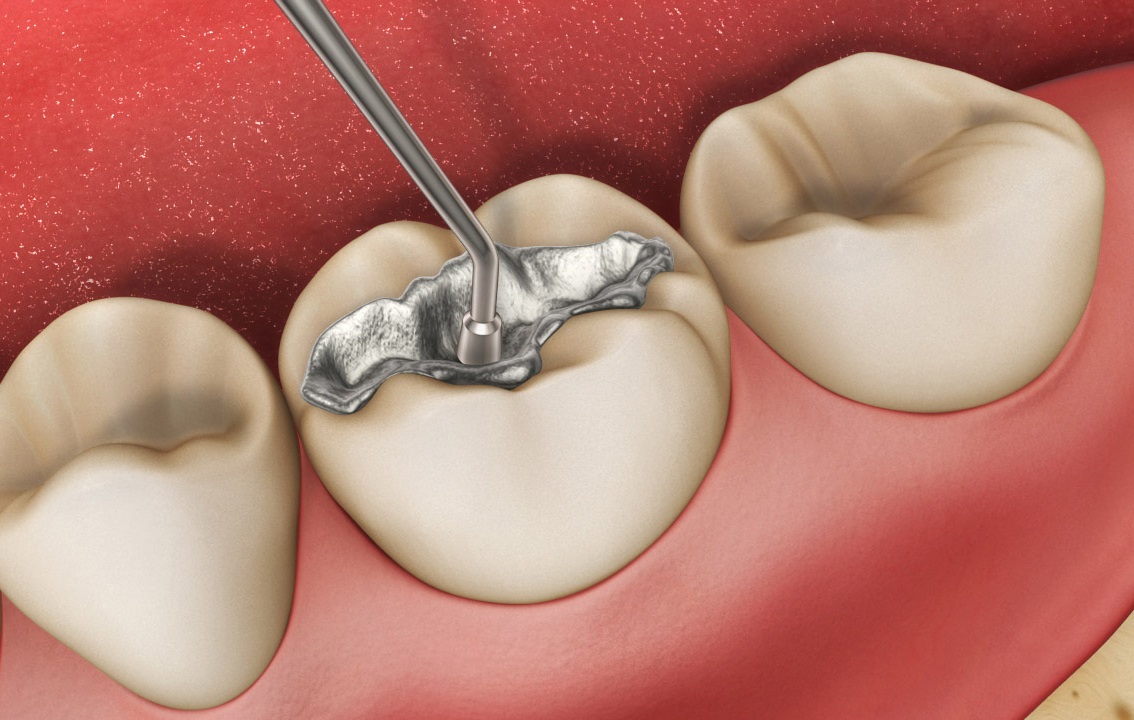 Изучение основных особенностей стоматологических услуг