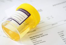 Разгадка тайны анализа мочи: понимание науки, лежащей в основе вашей мочи