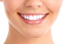 Как проводится отбеливание зубов